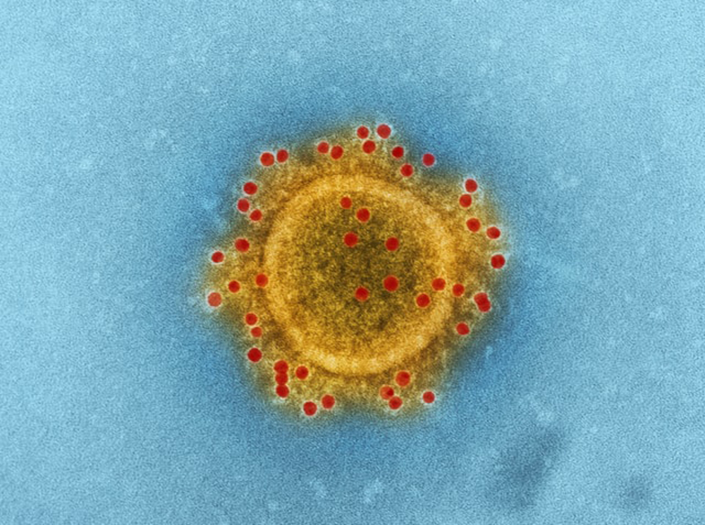 Vīruss var trāpīt smagi arī tad, ja neesi riska grupās. Ilzes Dragones Covid-19 pieredzes stāsts